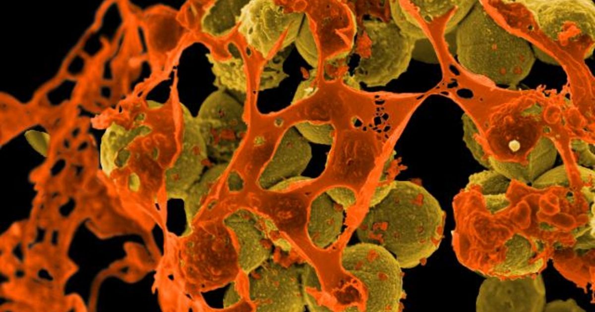 MRSA Study Details How Staph Is Transmitted Within Households Genome