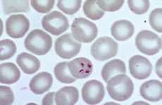 Babesia parasite in a blood cell
