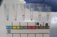 Blood typing by gel card method. Credit: SpicyMilkBoy/WikiMedia Commons