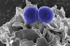 Scanning electromicrograph MRSA (blue bacteria) with a human white cell