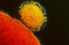 TEM of MERS-CoV. Credit: National Institute of Allergy and Infectious Diseases.
