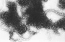 Respiratory Syncytial Virus electron micrograph