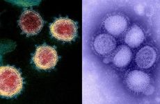 SARS-Flu.jpg