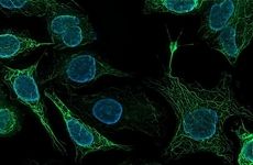 Human Cell Atlas Consortium Aims To Complete First Draft By 2022 ...