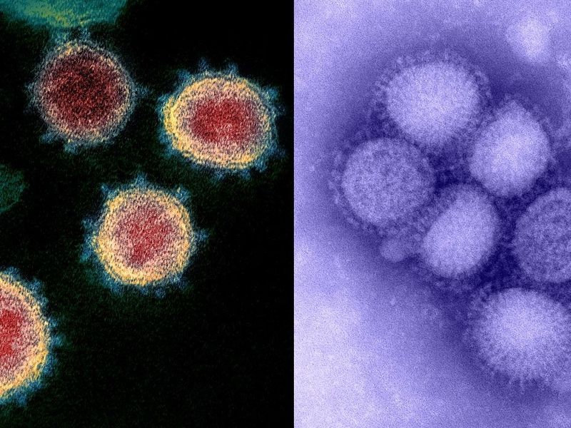 CDC Combined COVID-19/Influenza Test Gets FDA Emergency Use