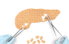 Pancreatic cancer_0.jpeg