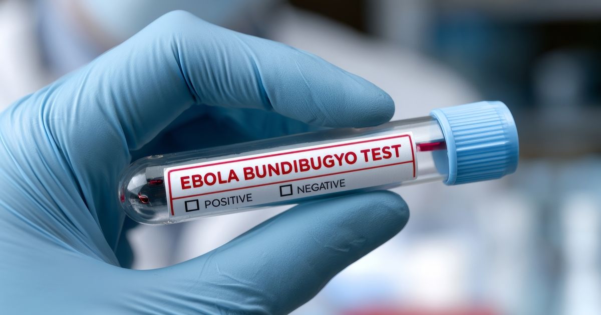 Bundibugyo Ebola Diagnostic Testing Ramps up as Outbreak Grows | GenomeWeb