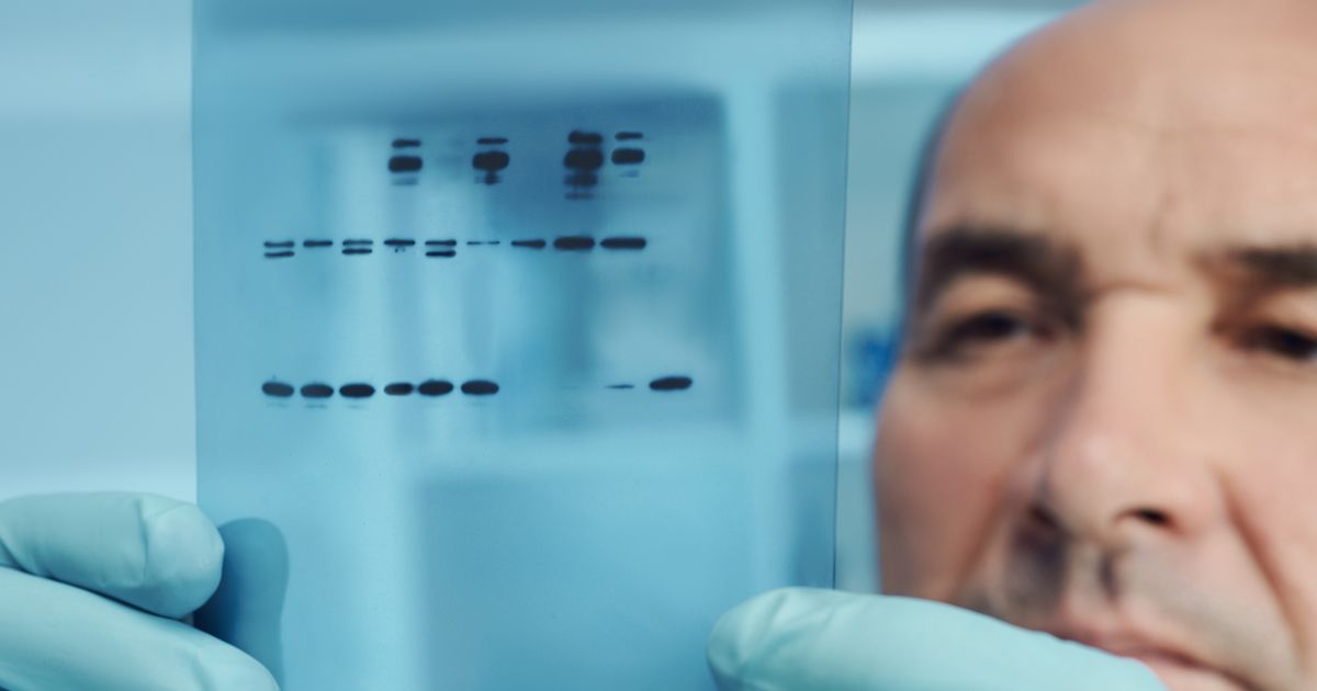 New Report Details Widespread Antibody Validation Image Manipulation Across the Industry
