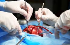 HeartTransplant