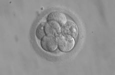 Human embryo