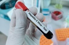 Hepatitis C Virus Test