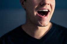 Stuttering GWAS Highlights Sex-Specific Genetic Risk, Parallels With ...