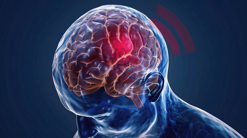 brain cancer