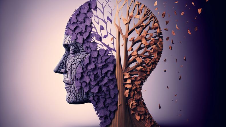 Alzheimer's